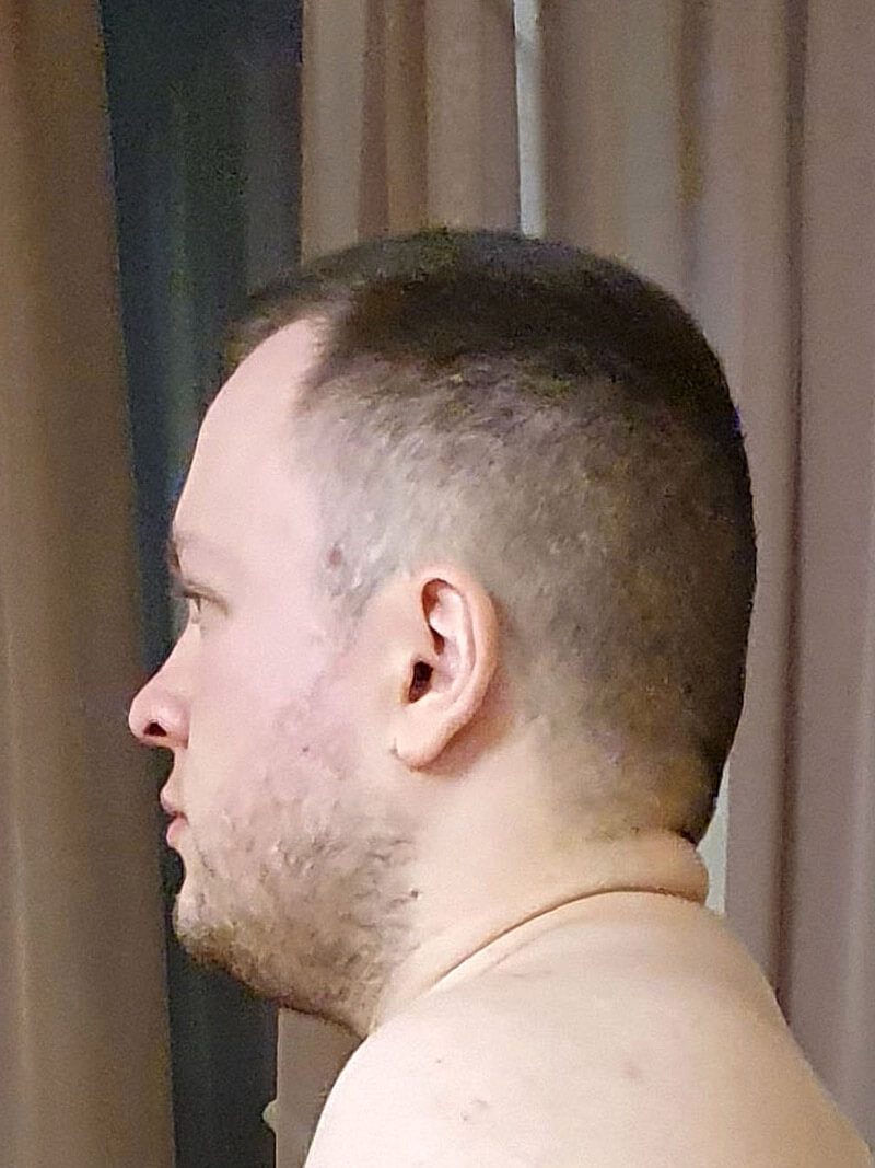 До